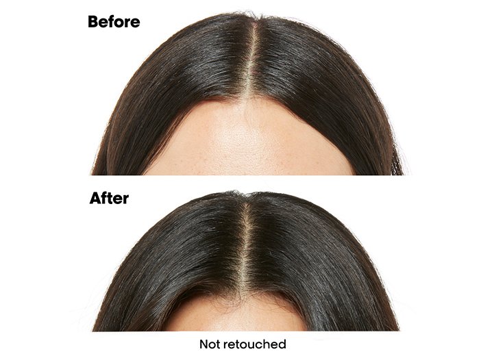 Before and after results with improved scalp comfort and healthier hair appearance after using anti-discomfort dermo regulator shampoo, not retouched hair