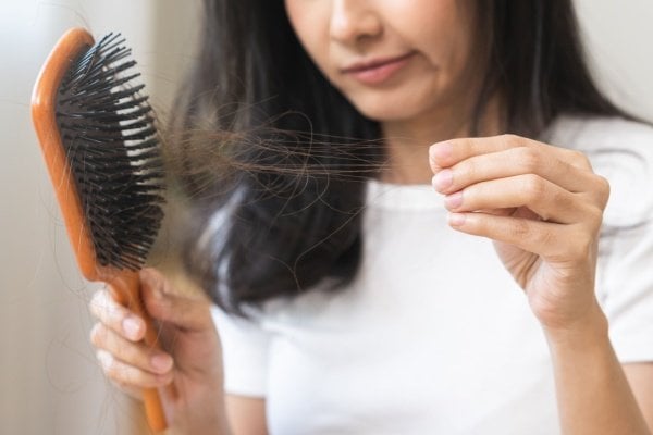 Scalp Dryness