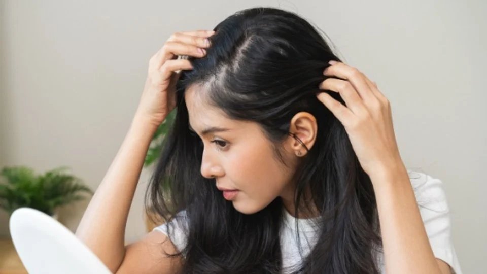 Causes of Hair Thinning