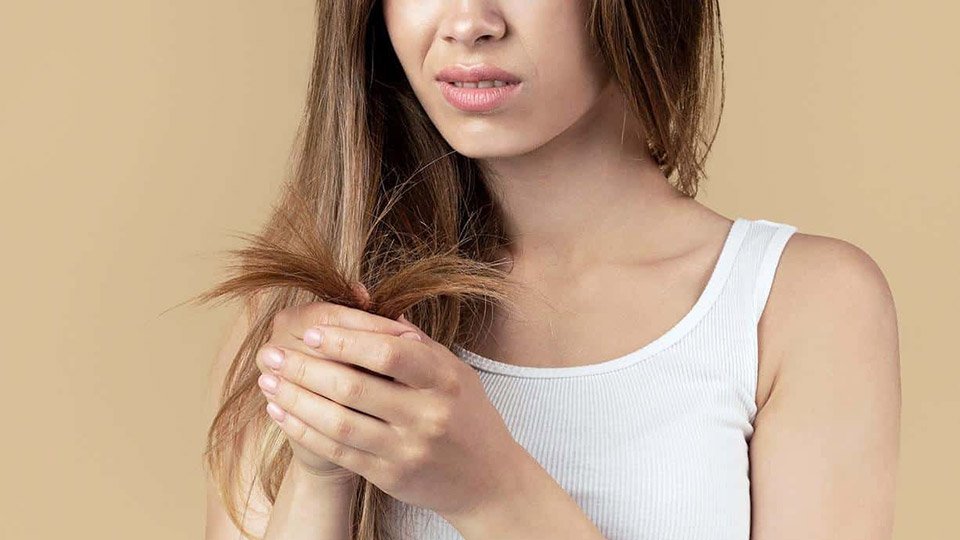 What is Dry Hair, its causes and treatments