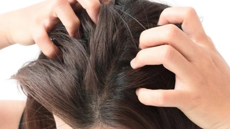 How To Get Rid of Oily Hair 