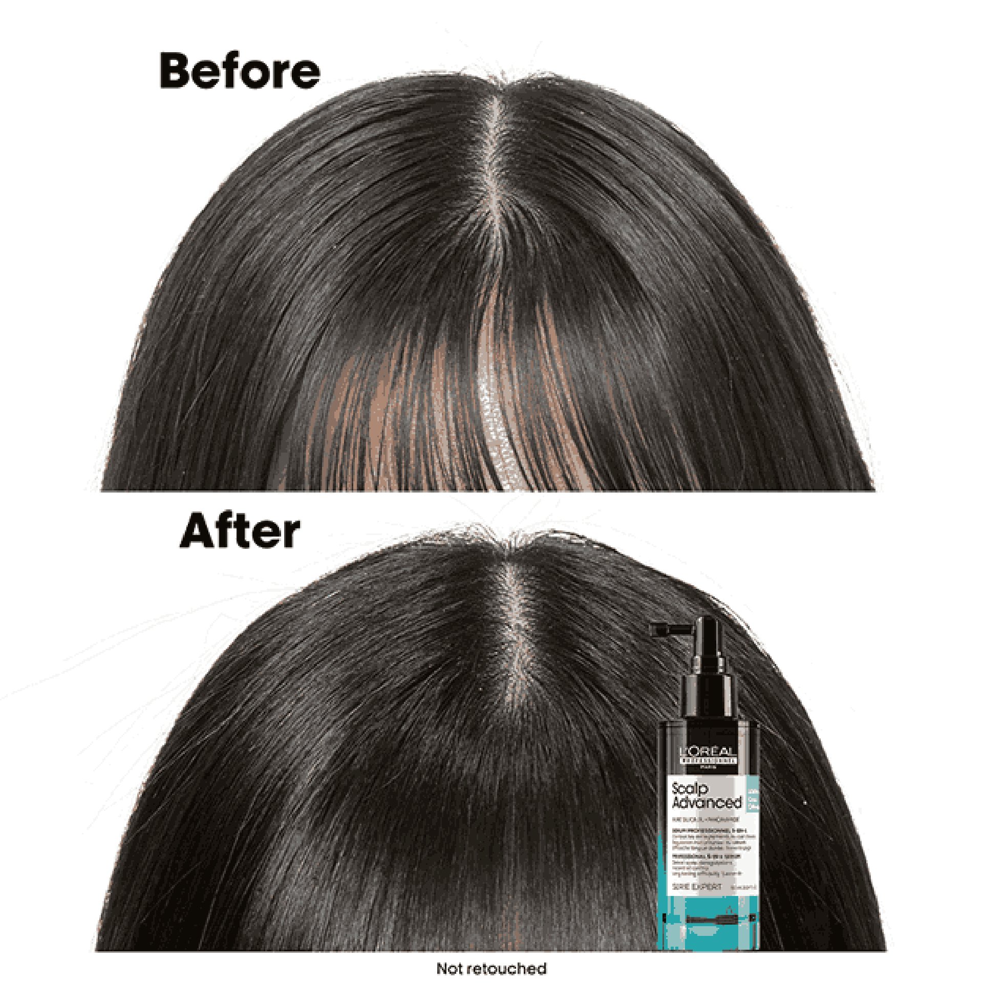 Scalp Advanced serum results