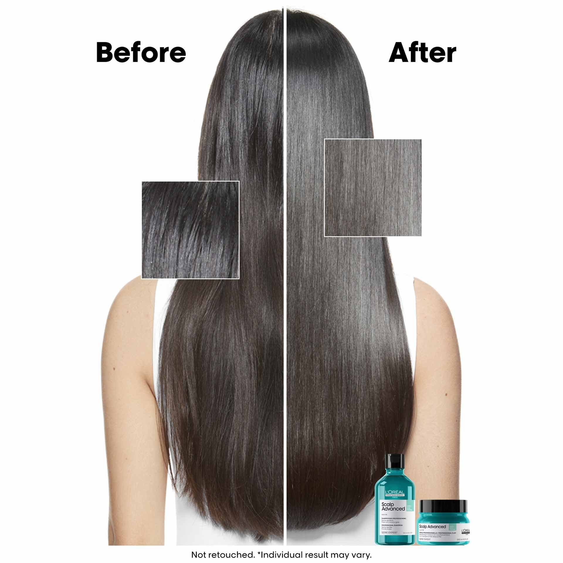 Before and after using Scalp Advanced clay shampoo