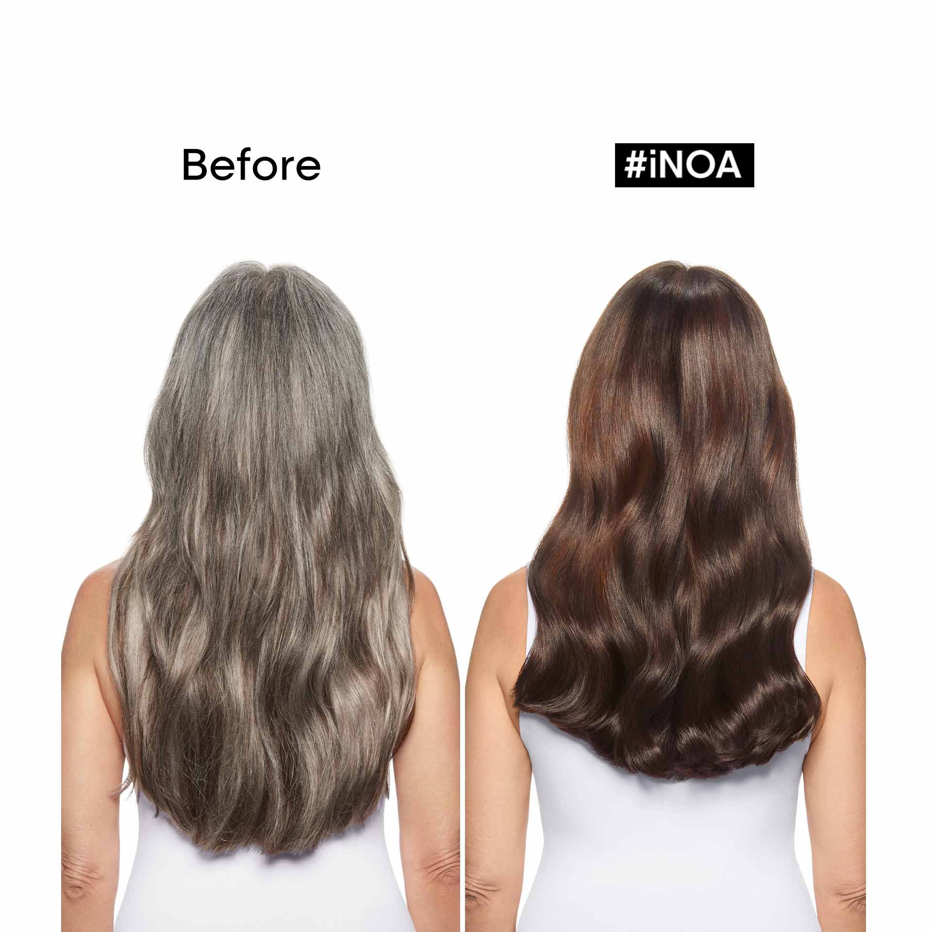 iNOA before and after