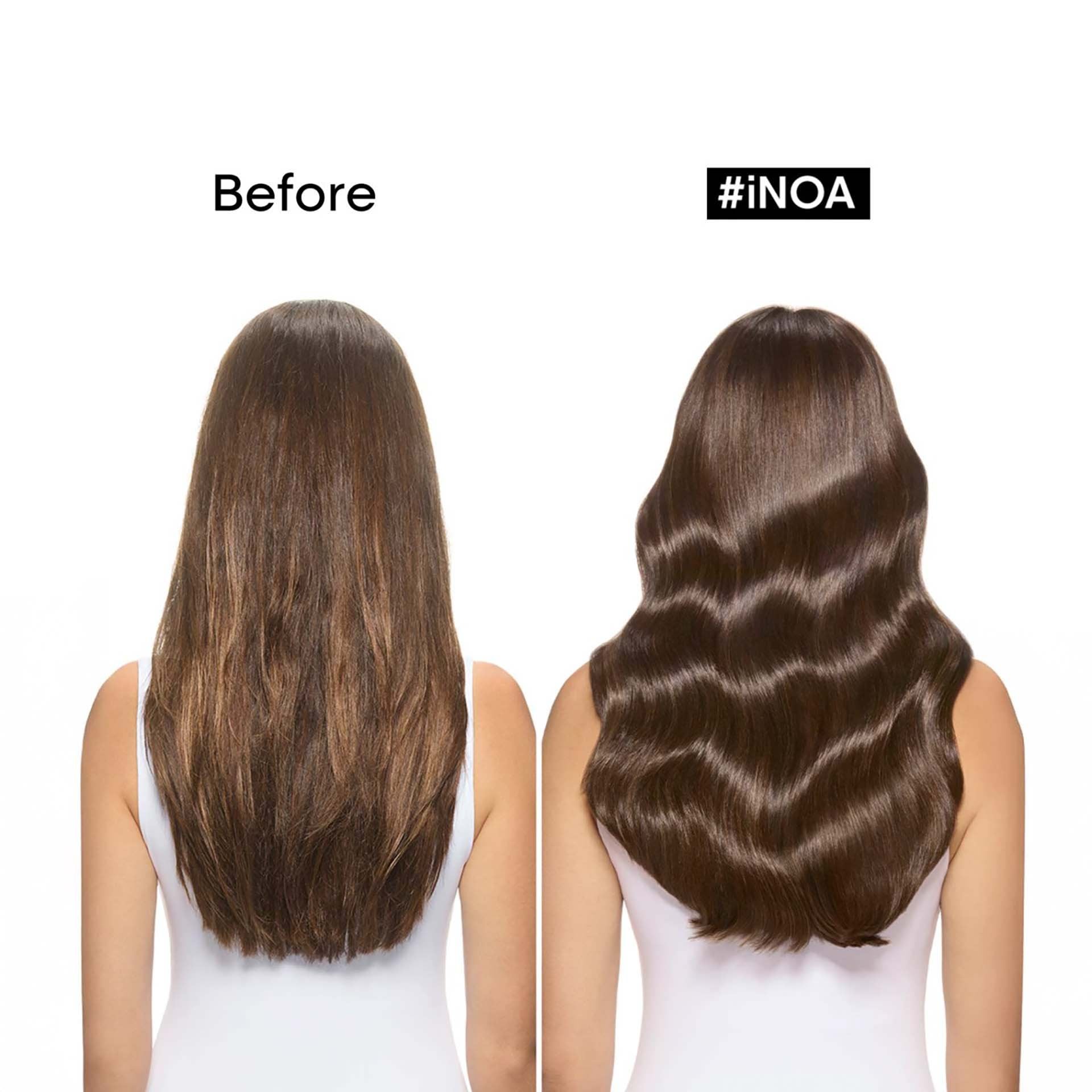 iNOA Before and After